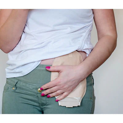 How to Change Your Ostomy Pouch: Step-by-Step Guide for Confident, Leak-Free Changing