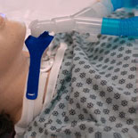 NX905D BX/10 - Marpac Pediatric Vent Circuit Anti-Disconnect Device