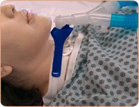 BX/10 - Marpac Adult Vent Circuit Anti-Disconnect Device, For Trach Ties® Tracheostomy Tube - Best Buy Medical Supplies