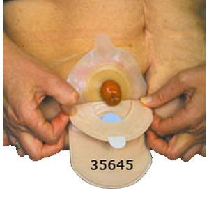 BX/10 - Two-piece Colostomy Closed-end Mini Pouch with Gore-tex® Integrated Charcoal Filter 6" L, Opaque, Odor-proof - Best Buy Medical Supplies