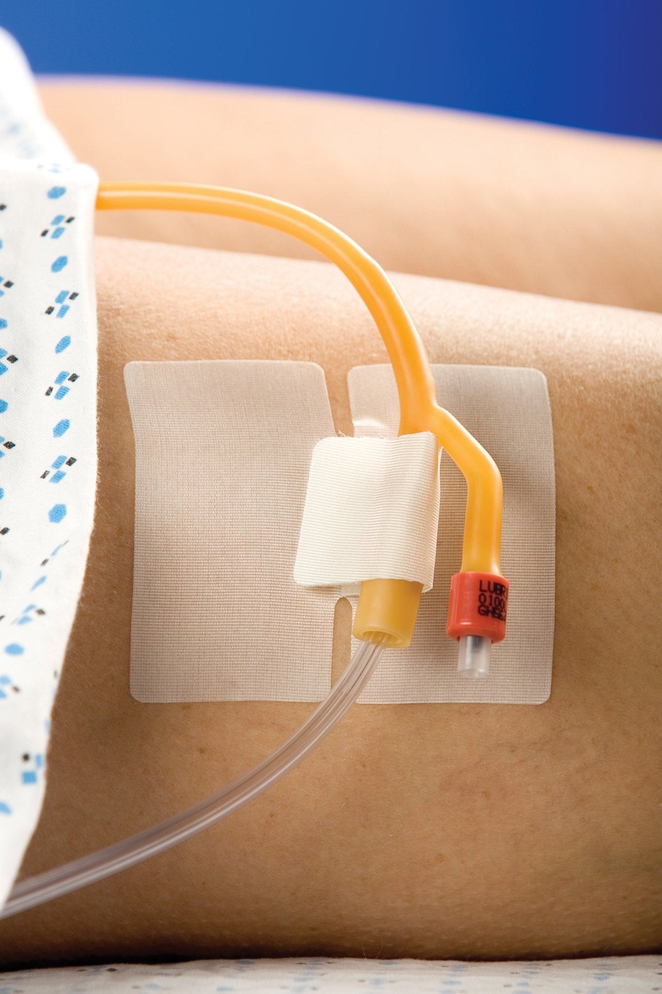 BX/50 - CATH-SECURE Multi-Purpose Tube Holder 2-1/2" Tab & 3" x 1-3/4" Base - Best Buy Medical Supplies