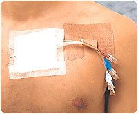 BX/50 - Derma Sciences Cath Strip™ Reclosable Catheter Fastener, Multi-Use, Latex-Free - Best Buy Medical Supplies