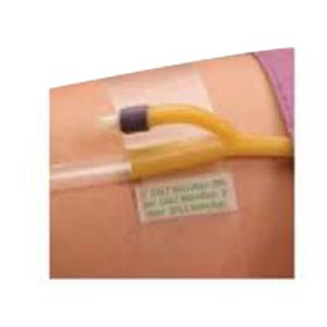EA/1 - Dale Hold-N-Place® Adhesive Patch Foley Catheter Holder, One Size, Latex-Free - Best Buy Medical Supplies