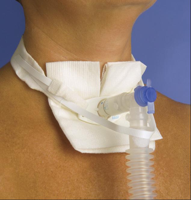 EA/1 - Pepper Medical One Piece Adult Trach-Tie&reg; with Ventilator Anti-disconnect Device - Best Buy Medical Supplies