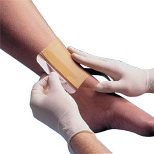 EA/1 - Smith & Nephew Replicare® Hydrocolloid Wound Dressing, 8" x 8" - Best Buy Medical Supplies