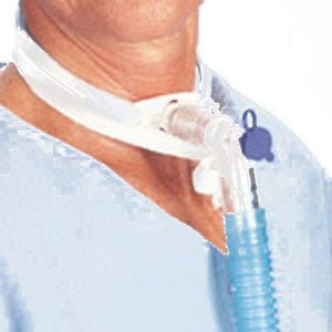 PK/12 - Posey Secure Tracheostomy Tube Ties, 9" to 15-1/2" Medium - Best Buy Medical Supplies
