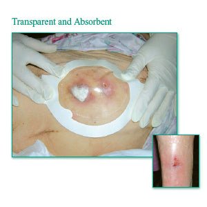 BX/10 - Tegaderm Clear Absorbent Acrylic Dressing 3" x 3-3/4" Oval - Best Buy Medical Supplies