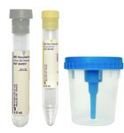 CA/50 - BD Vacutainer&reg; Urine Collection Kit with Screw Cap Cup - Best Buy Medical Supplies