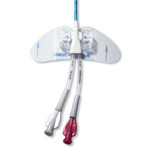 EA/1 - Bard StatLock&reg; PICC Plus Stabilization Device Adult Size, Butterfly Sliding Posts - Best Buy Medical Supplies
